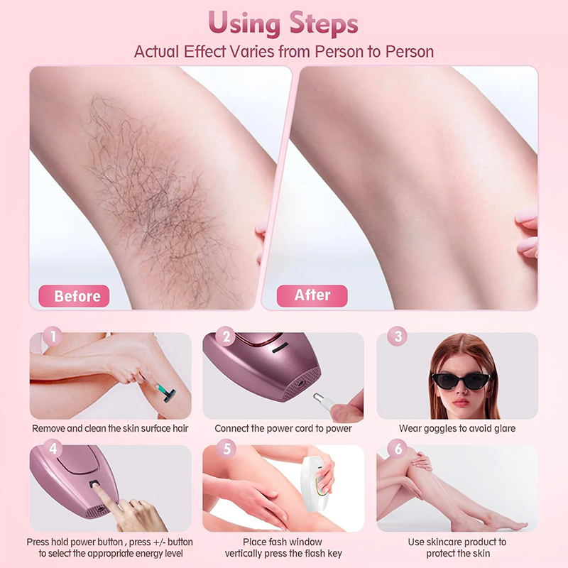 IPL laser Hair Remover Hair Cu - Industrial Laser Cutter review and price